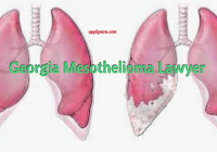 Georgia Mesothelioma Lawyer