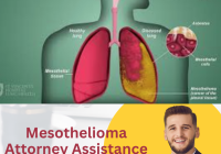 Mesothelioma Attorney Assistance