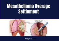 Mesothelioma Average Settlement