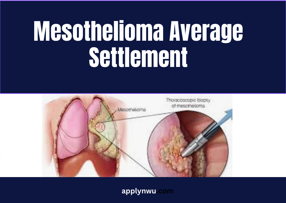 Mesmerizing Average Settlement For Mesothelioma Cases Capture Illustration Mesmerizing Average Settlement For Mesothelioma Cases Capture Illustration