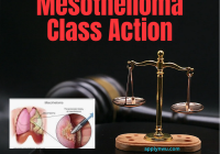 Mesothelioma Class Action
