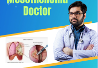 Mesothelioma Doctor