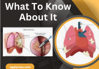 Mesothelioma | What To Know About It