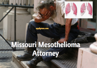 Missouri Mesothelioma Attorney